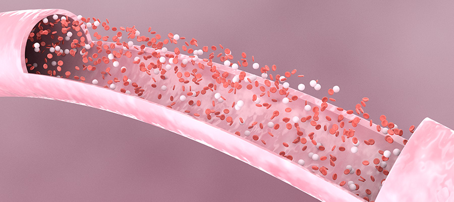 The Hottest Trends 2022: Platelet Rich Fibrin, Part I